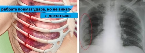 Болки в гърдите (гръдния кош). Какво значат стягане, тежест, бодежи ...